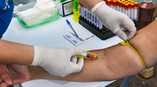 Ilustrativa - Kit único pode identificar patógenos causadores de infecções e poderá se tornar realidade já em 2021 Ilustrativa - Kit único pode identificar patógenos causadores de infecções e poderá se tornar realidade já em 2021