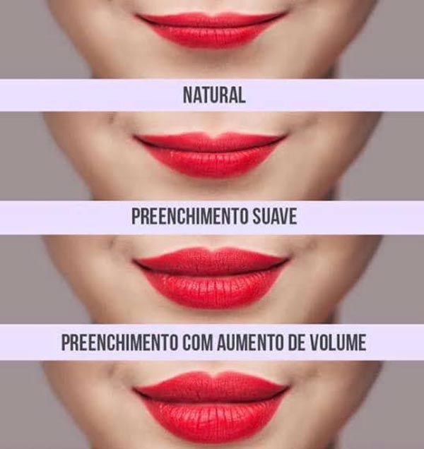 Mais volume e contorno destacado com as técnicas de preenchimento Mais volume e contorno destacado com as técnicas de preenchimento