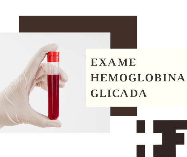 Divulgação - Diferente do exame de glicemia comum, o exame de hemoglobina glicada não necessita de jejum Divulgação - Diferente do exame de glicemia comum, o exame de hemoglobina glicada não necessita de jejum