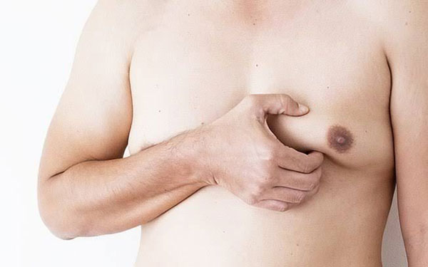 Ilustrativa - Apesar de raro, estimativas indicam que 1% dos casos de câncer de mama afeta homens Ilustrativa - Apesar de raro, estimativas indicam que 1% dos casos de câncer de mama afeta homens