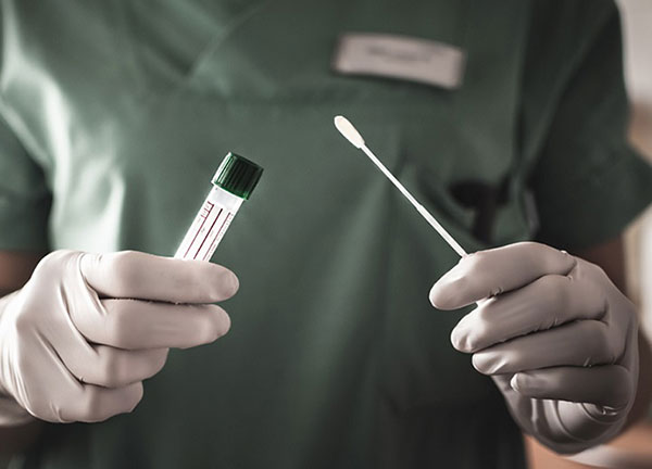 Divulgação - Testes rápidos devem chegar na próxima semana, se o fornecedor cumprir prazo de entrega Divulgação - Testes rápidos devem chegar na próxima semana, se o fornecedor cumprir prazo de entrega