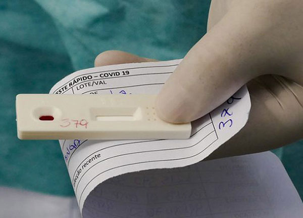 Divulgação - O teste rápido é capaz de detectar a presença de anticorpos produzidos pelas células de defesa do corpo humano contra o vírus SARS-CoV-2 Divulgação - O teste rápido é capaz de detectar a presença de anticorpos produzidos pelas células de defesa do corpo humano contra o vírus SARS-CoV-2