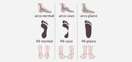 Divulgação - Tipos de pés - Foto: Divulgação