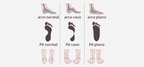Divulgação - Tipos de pés - Foto: Divulgação Divulgação - Tipos de pés - Foto: Divulgação