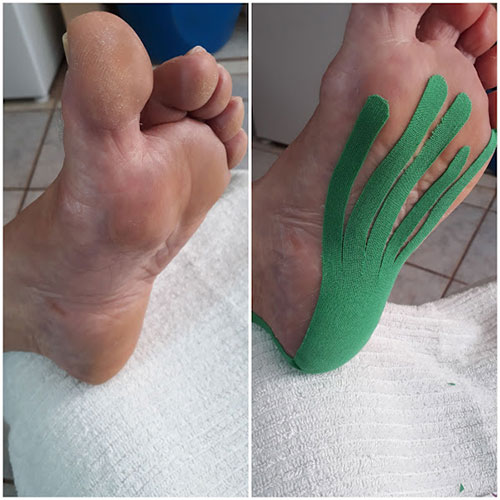 Divulgação - As bandagens melhoram a circulação sanguínea e fortalecem a musculatura - Foto: Divulgação Divulgação - As bandagens melhoram a circulação sanguínea e fortalecem a musculatura - Foto: Divulgação