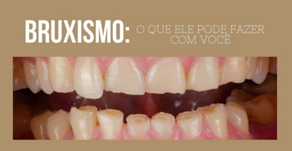 Divulgação - Foto: Divulgação/Sartori Divulgação - Foto: Divulgação/Sartori