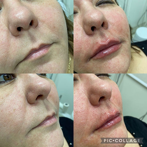 Divulgação - Antes e depois - Foto: Divulgação Divulgação - Antes e depois - Foto: Divulgação