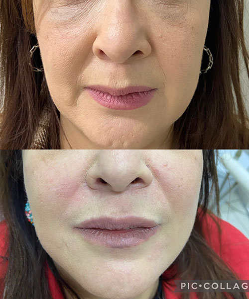 Divulgação - A harmonização facial pode ajudar a melhorar a autoestima e a confiança de uma pessoa - Foto: Divulgação